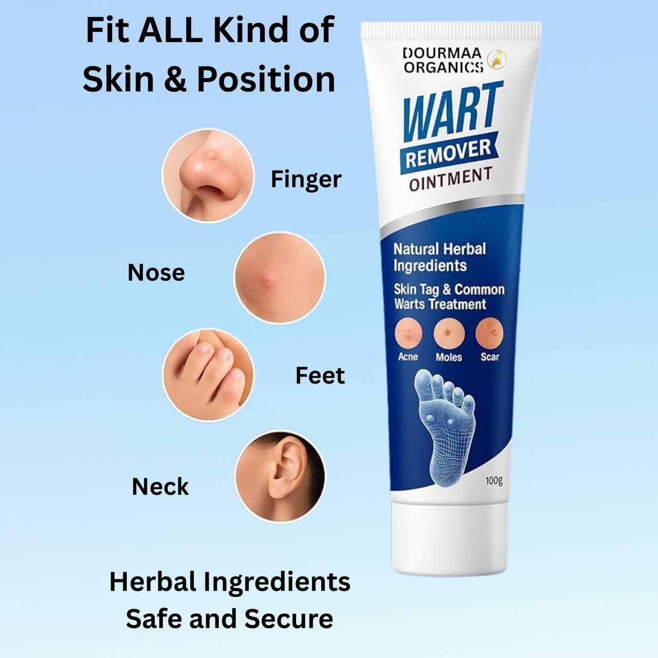 Wart Remover Ointment for Safe & Effective Skin Wart Removal-100g