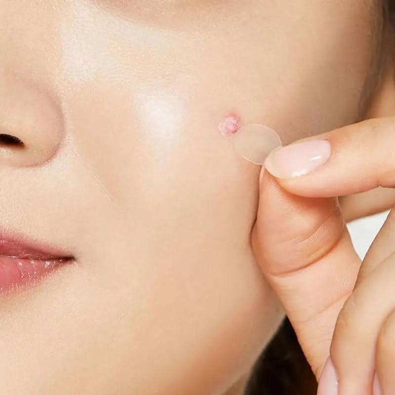 Pimple Patch for Acne & Blemish Removal - 144 Dots