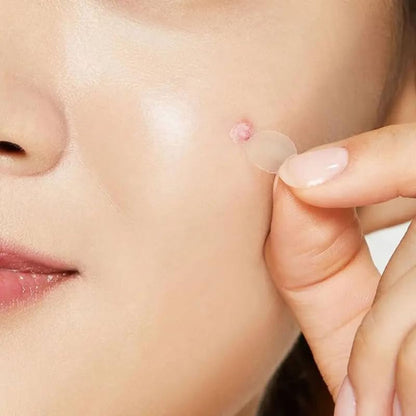 Pimple Patch for Acne & Blemish Removal - 144 Dots