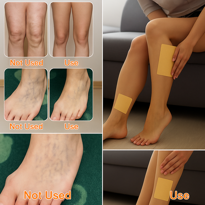 Varicose Veins Treatment Herbal Care Patches - 12 Pcs