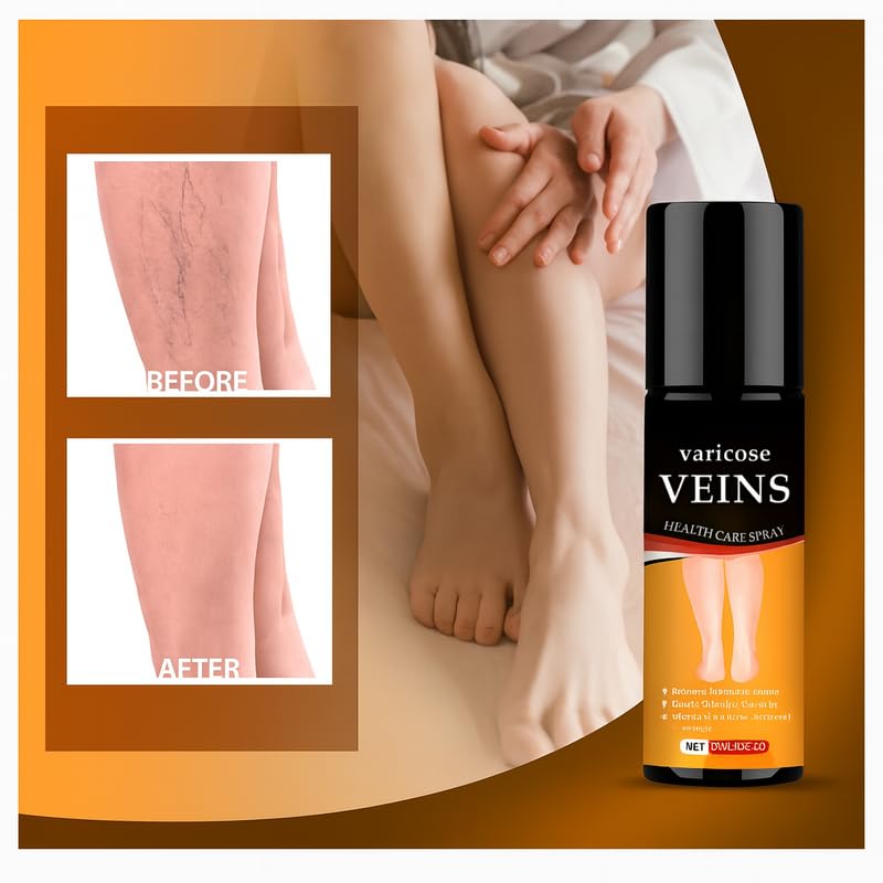 Varicose Veins Spray | Quick Relief from Leg Pain – 30ml (Pack of 1)