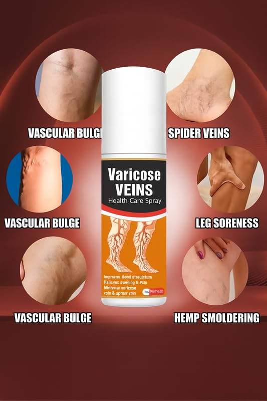 Varicose Veins Pain Relief Spray – 60ml (Pack of 1)