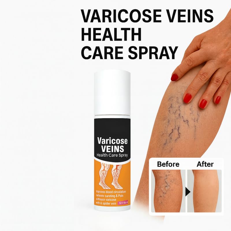 Varicose Veins Pain Relief Spray – 60ml (Pack of 1)