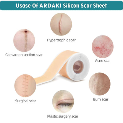 Reusable Silicone Scar Sheets for Old & New Scar Treatment