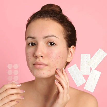 Pimple Patch for Acne & Blemish Removal - 36 Dots