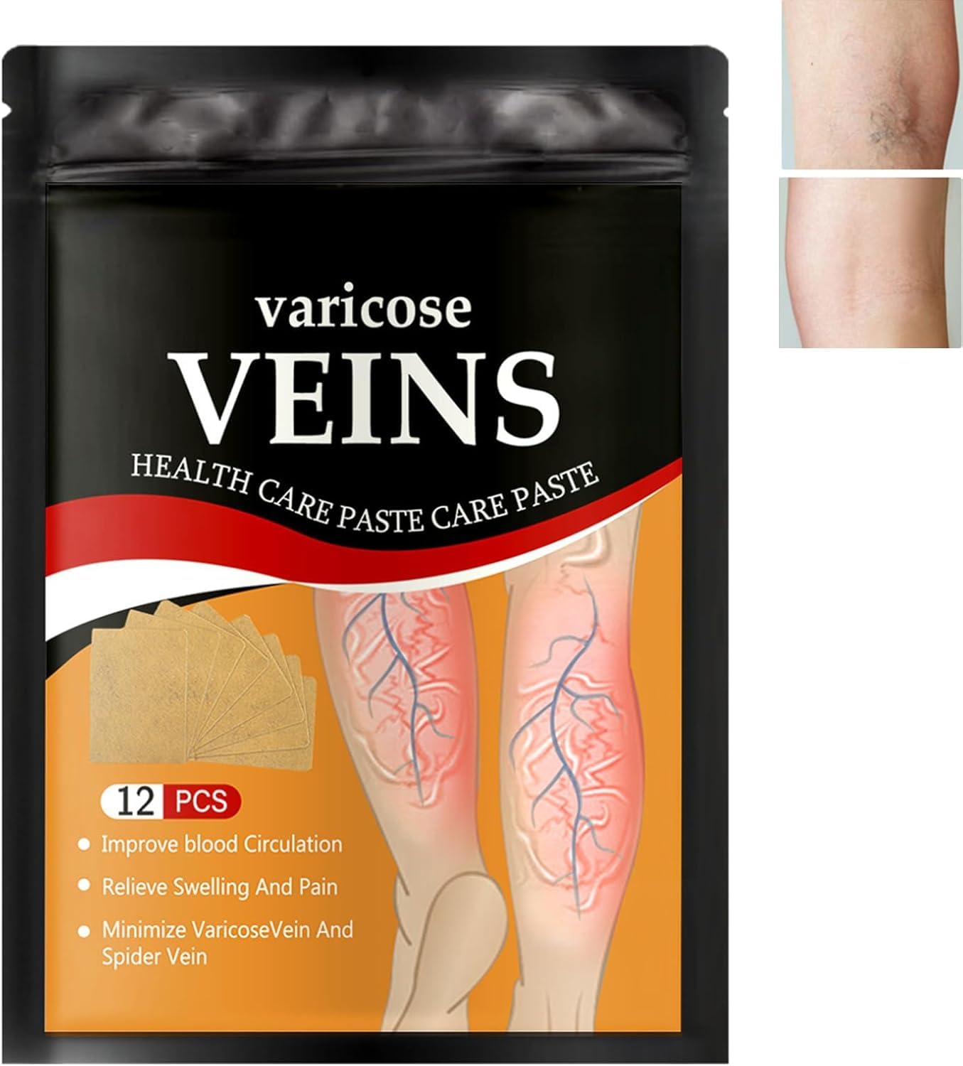 Varicose Veins Treatment Herbal Care Patches - 12 Pcs