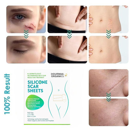 Reusable Silicone Scar Sheets for Old & New Scar Treatment