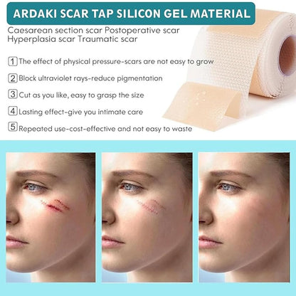 Reusable Silicone Scar Sheets for Old & New Scar Treatment