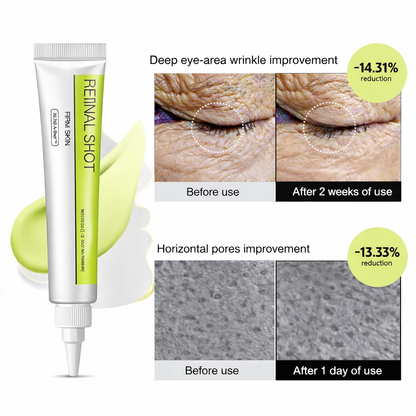 Retinal Shot Tightening Booster Cream for Firm Skin - Pack of 1