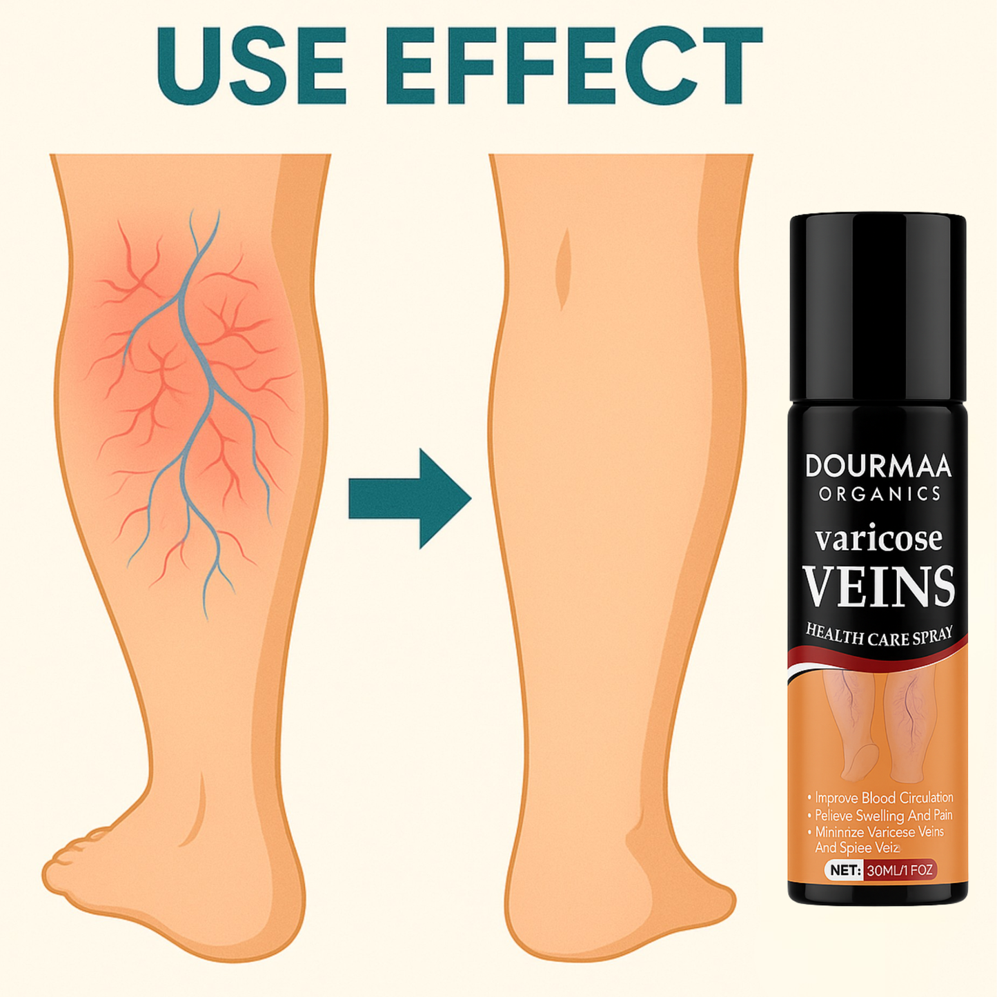 Varicose Veins Spray | Quick Relief from Leg Pain – 30ml (Pack of 2)