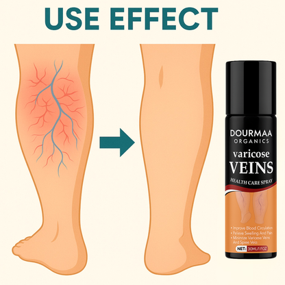 Varicose Veins Spray | Quick Relief from Leg Pain – 30ml (Pack of 2)